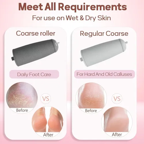 Image of callus remover for feet dead skin remover pedicure tools Callus Remover Hard and Dead Skin Remover Electric Foot Callus 