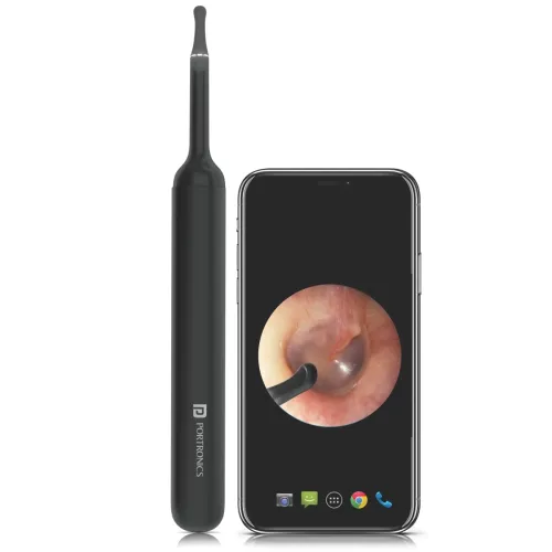 Image of Portronics Xlife Smart Wireless Ear Otoscope Cleaner with 6 LED Lights, FHD 1080 Camera, 3 Mega pixels Endoscope, Contro