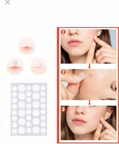 Image of Priyangkrita Acne Pimple Patch 36g
