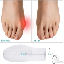 Toe Separator for Feet