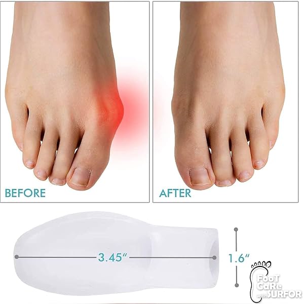 Toe Separator for Feet